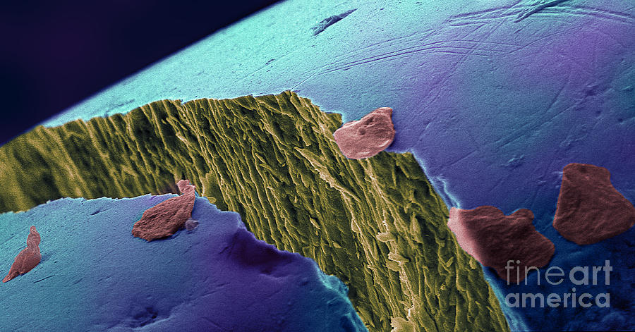 Human Tooth Crack With Cheek Cells, Sem Photograph by Ted Kinsman