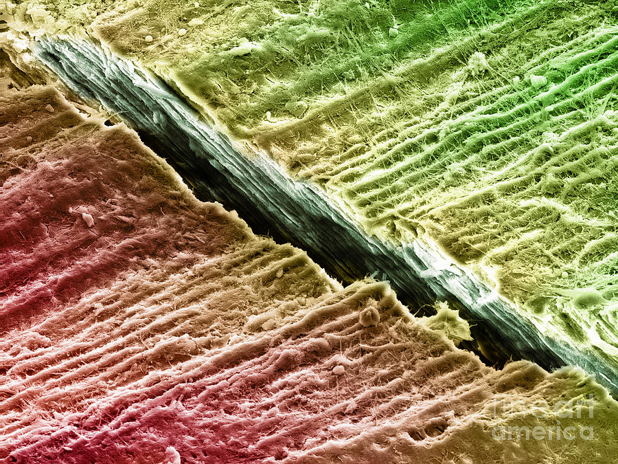 Human Tooth Dentine, Sem Photograph by Ted Kinsman