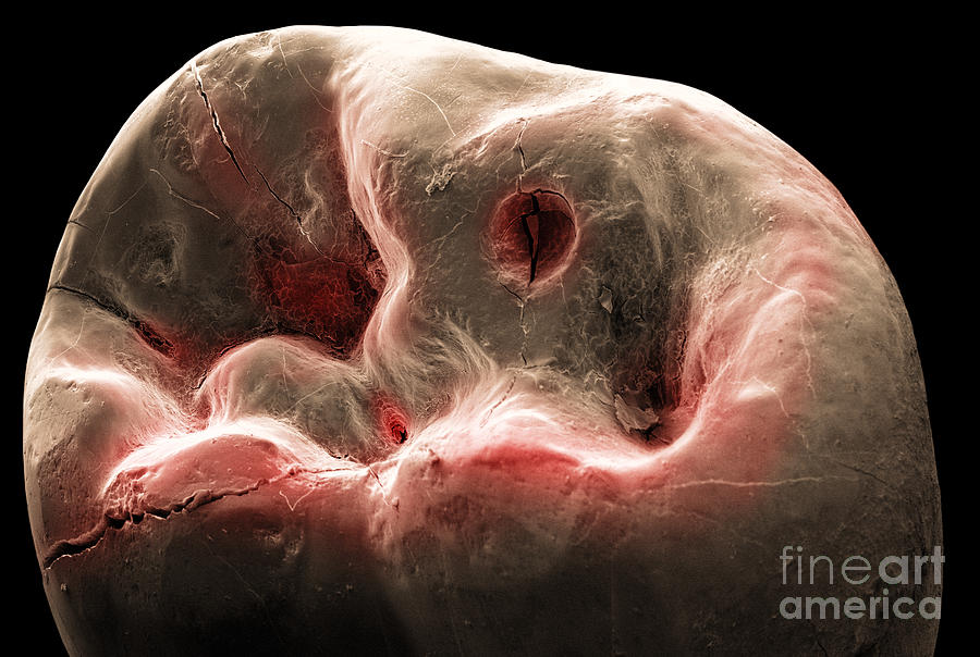 Human Tooth, Sem Photograph by Ted Kinsman