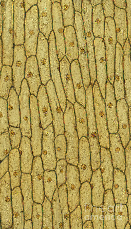 Iodine Stained Onion Cells Photograph by Ted Kinsman
