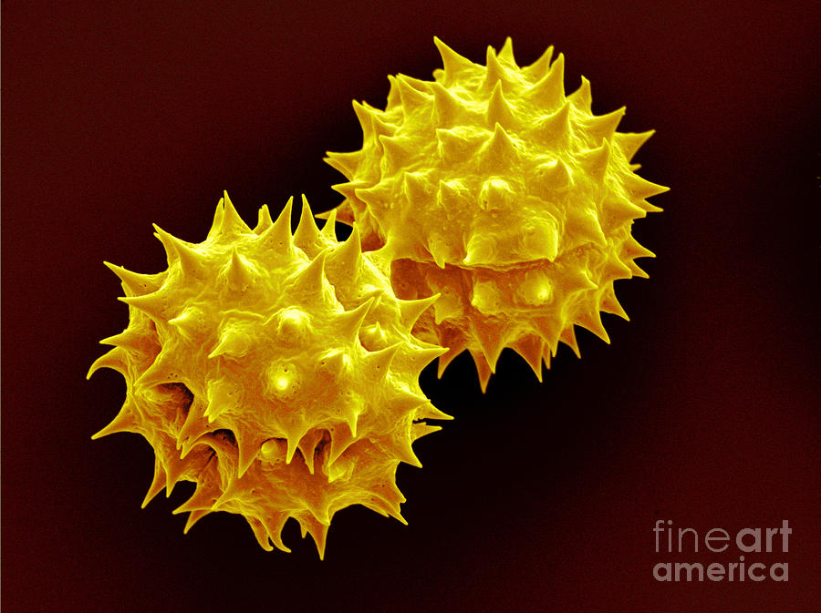 Jerusalem Artichoke Pollen, Sem Photograph by Scimat