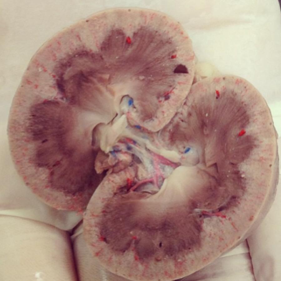 Kitty Kat Kidney! Photograph by Brittany Weigang