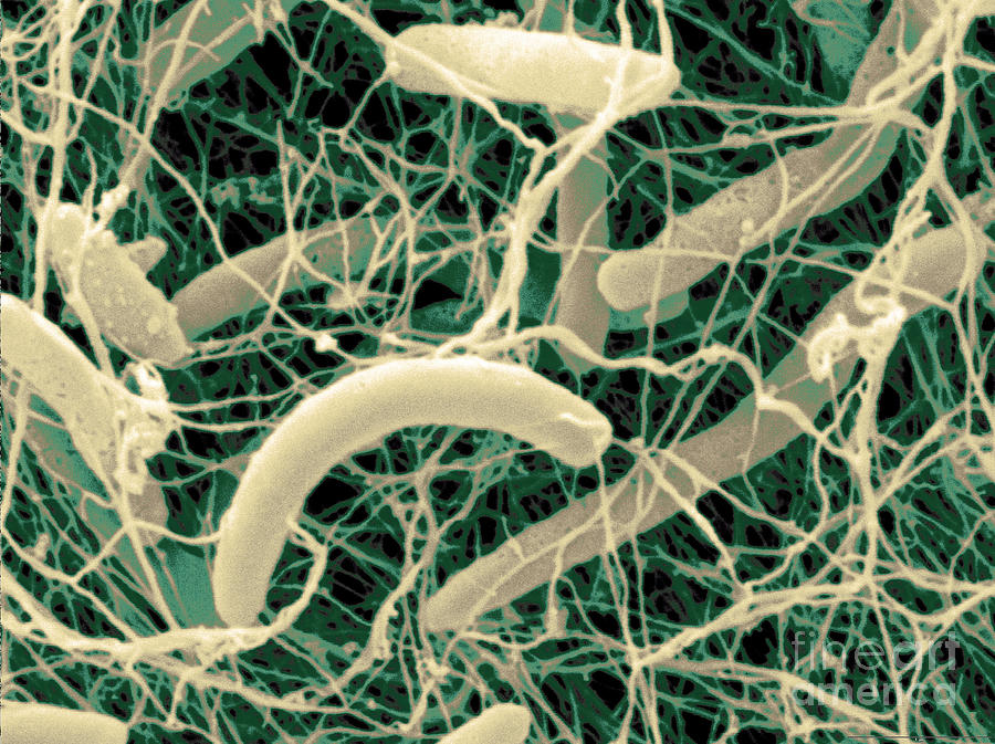 Kombucha Bacteria, Sem Photograph by Scimat