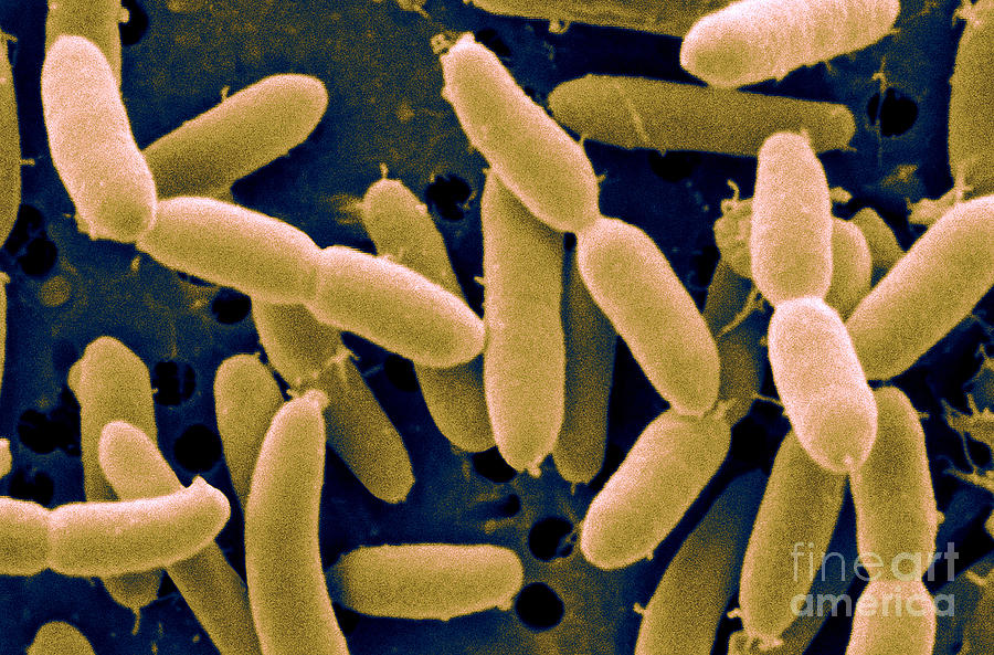 Lactobacillus Acidophilus Photograph by Scimat