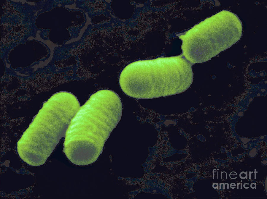 Lactobacillus Curvatus Photograph by Scimat