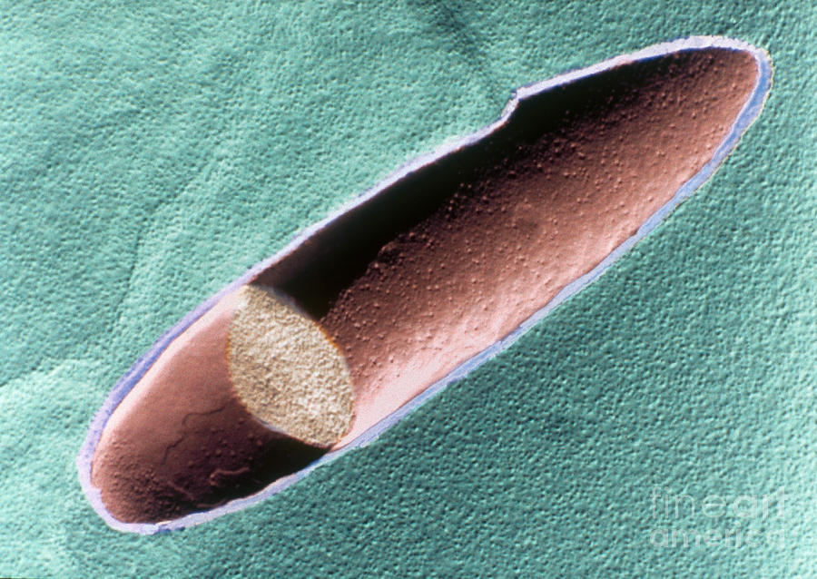 Lactobacillus Delbrueckii Subsp Photograph by Scimat