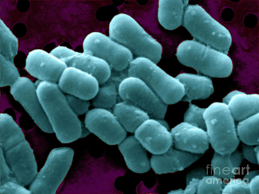 Lactobacillus Fermentum Photograph by Scimat