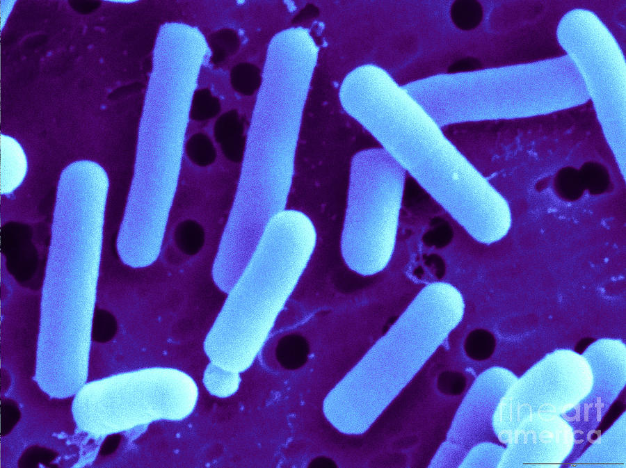 Lactobacillus Reuteri Photograph by Scimat.
