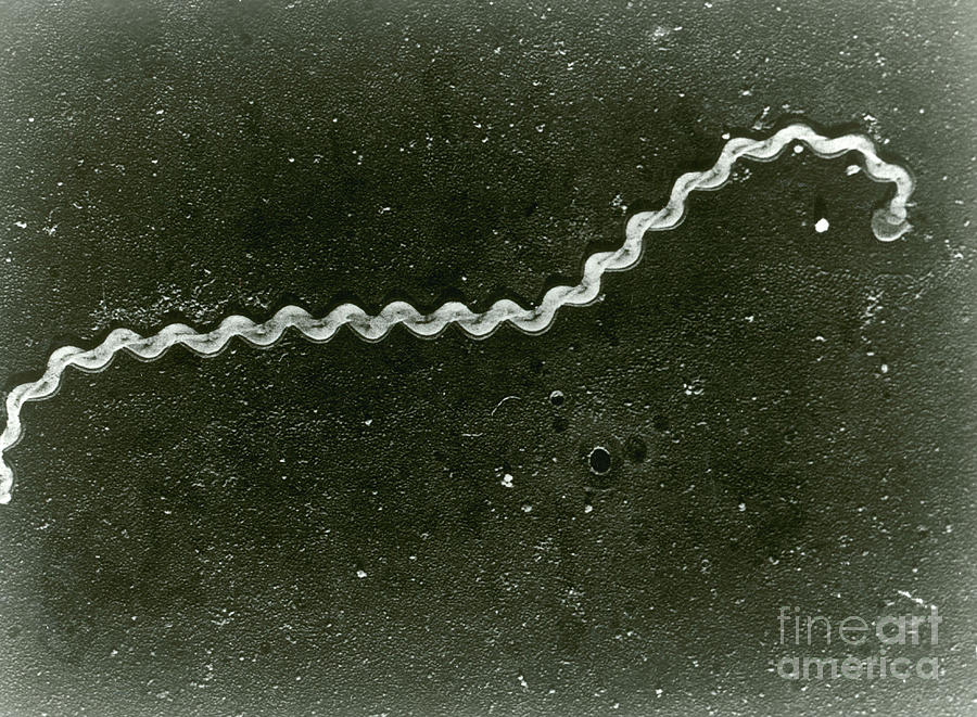 Science Photograph - Leptospira, Sem by Omikron