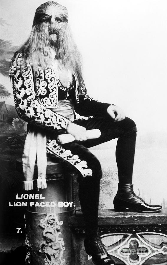 Lion Photograph - Lion-faced Man, 1907 by Granger