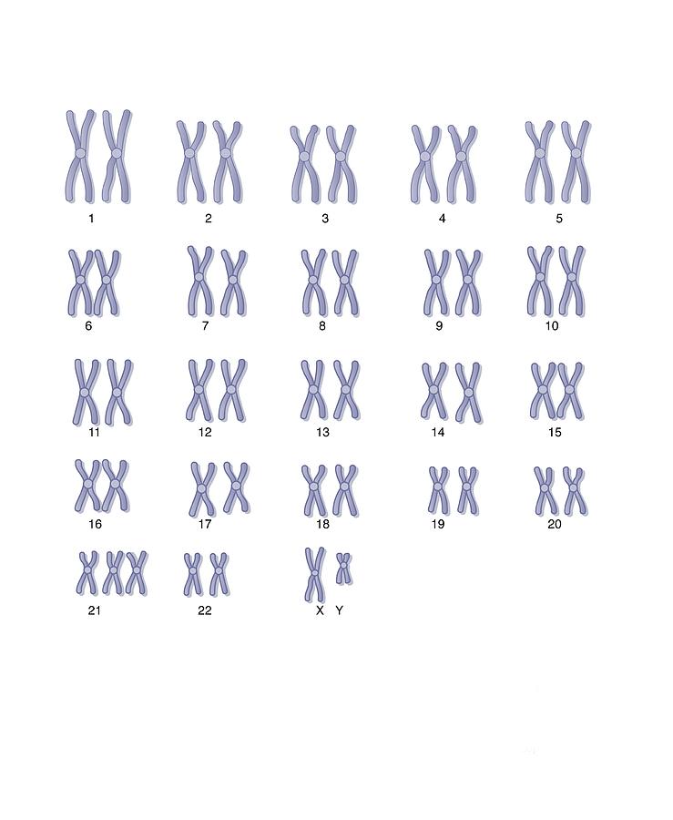 Down's Syndrome Photograph - Male Downs Syndrome Karyotype, Artwork by Peter Gardiner