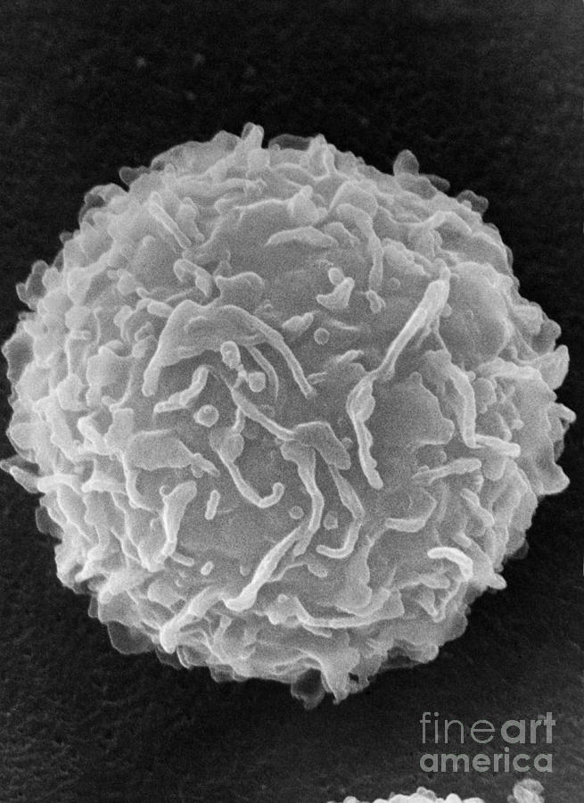 Mast Cell SEM Photograph by Don Fawcett and E Shelton and Photo Researchers