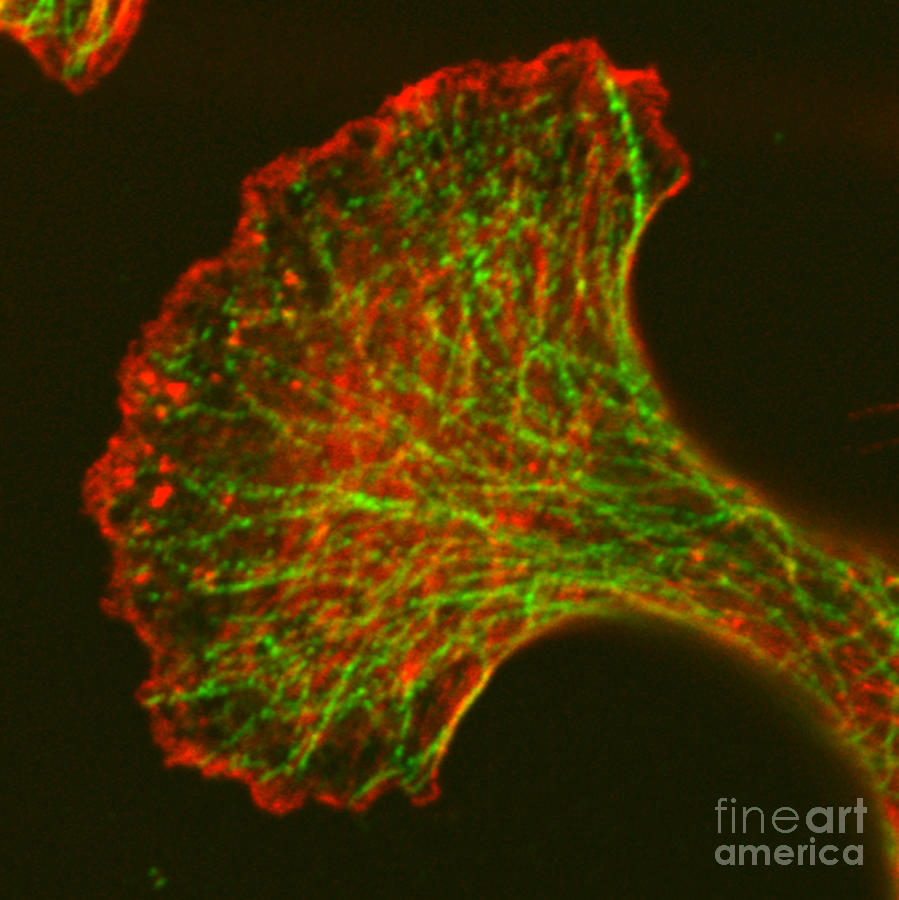 Microfilaments And Microtubules, Fm Photograph by Science Source