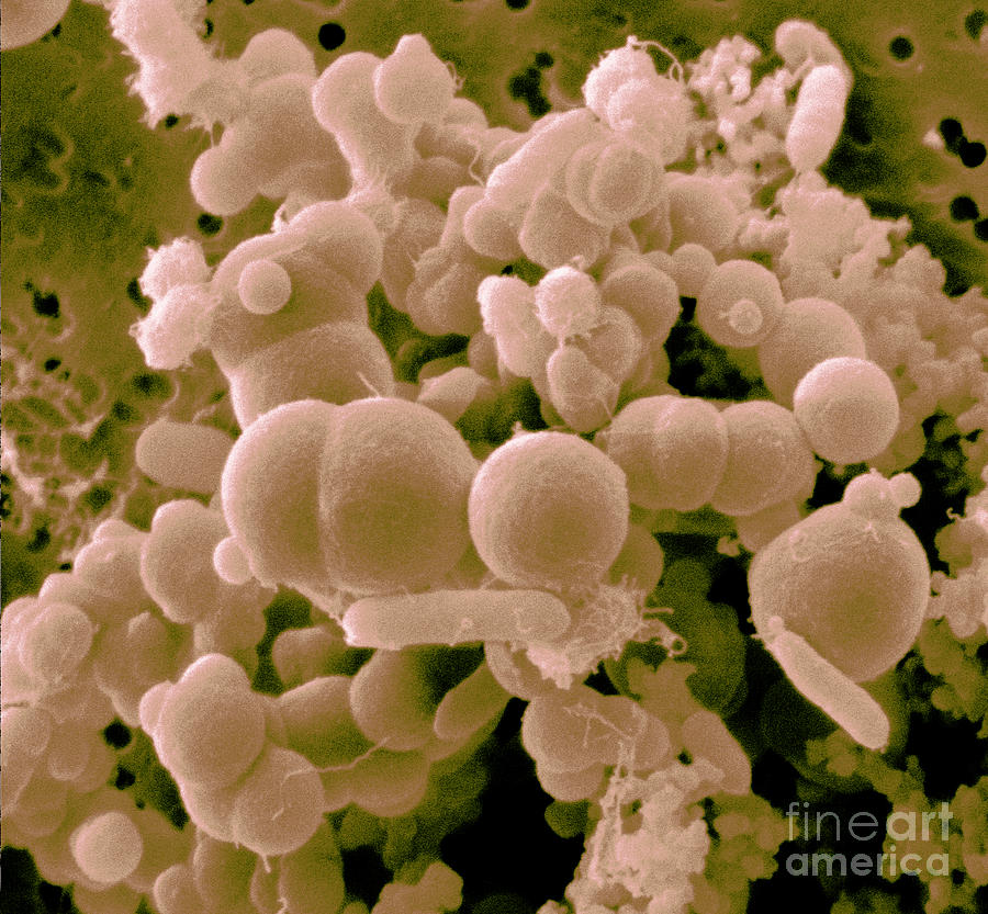 Microorganisms In Crow Droppings, Sem Photograph by Scimat