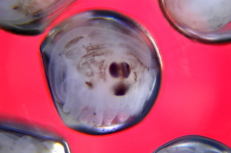 Spider Photograph - Microscopic eggs 004 by Marcus Kett