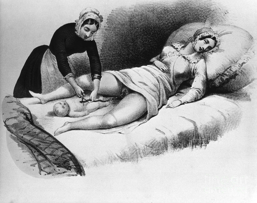 Midwife Cutting Umbilical Cord, 1850 Photograph by Science Source