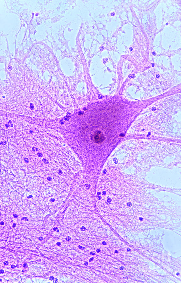 Histology Photograph - Motor Neuron From Spinal Cord by M I Walker