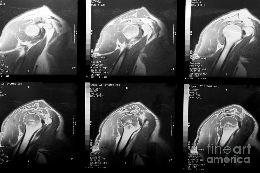 MRI of Rotator Cuff Photograph by Karen Foley