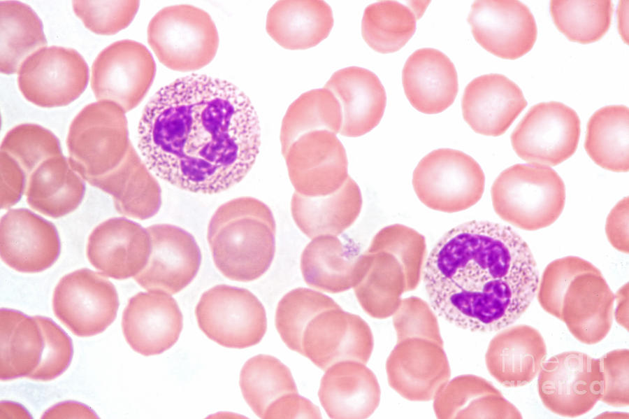 Neutrophils In Peripheral Blood Smear Photograph by M. I. Walker
