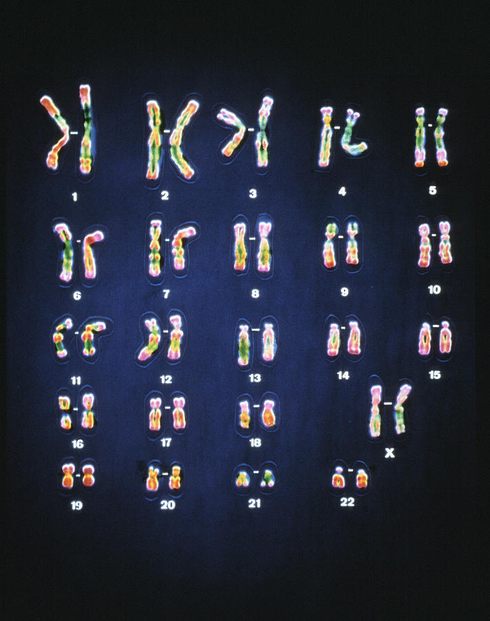 Normal Female Chromosomes Photograph by Cnri