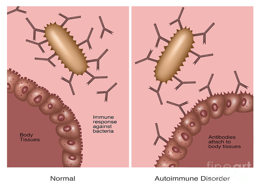 Normal Immune System & Autoimmune Photograph by Gwen Shockey