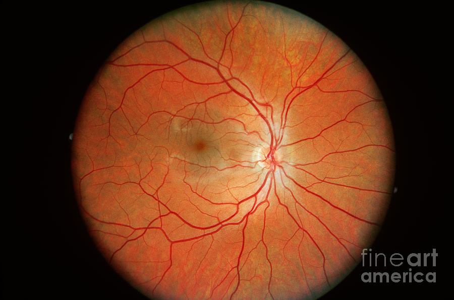 Normal Retina Photograph by Science Source