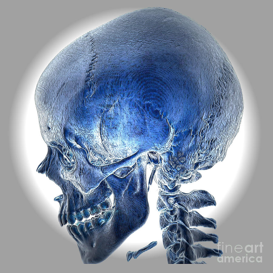 Normal Skull, 3d Ct Scan Photograph by Living Art Enterprises