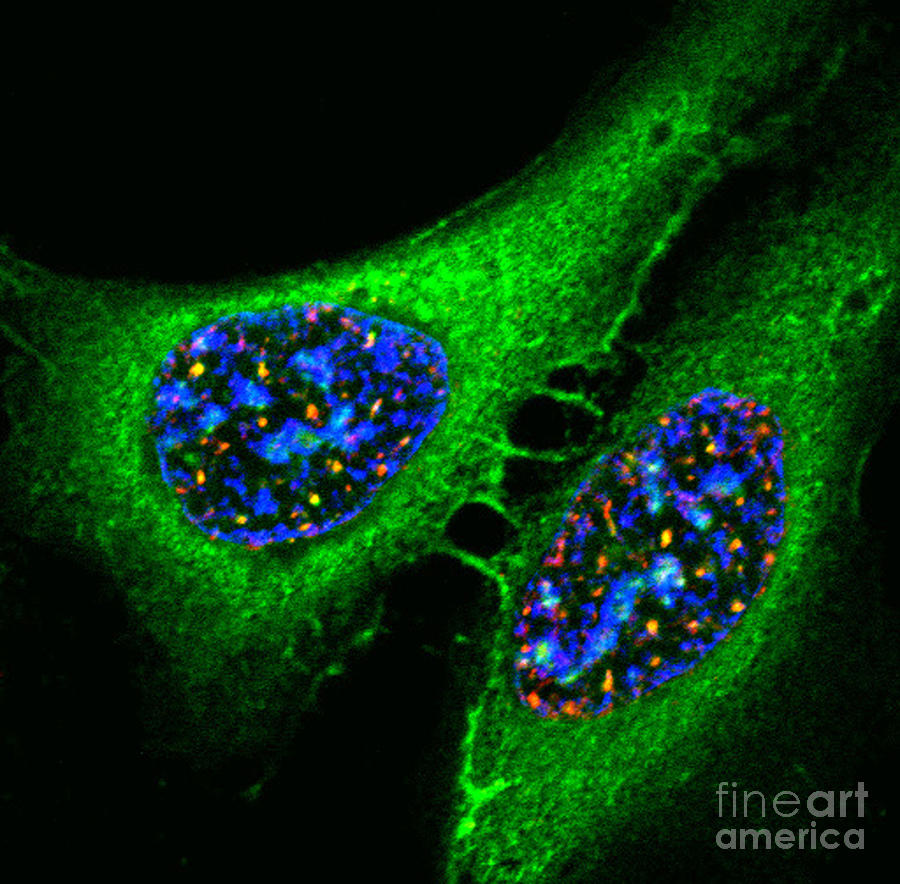 Osteosarcoma Cells, Fm Photograph by Science Source