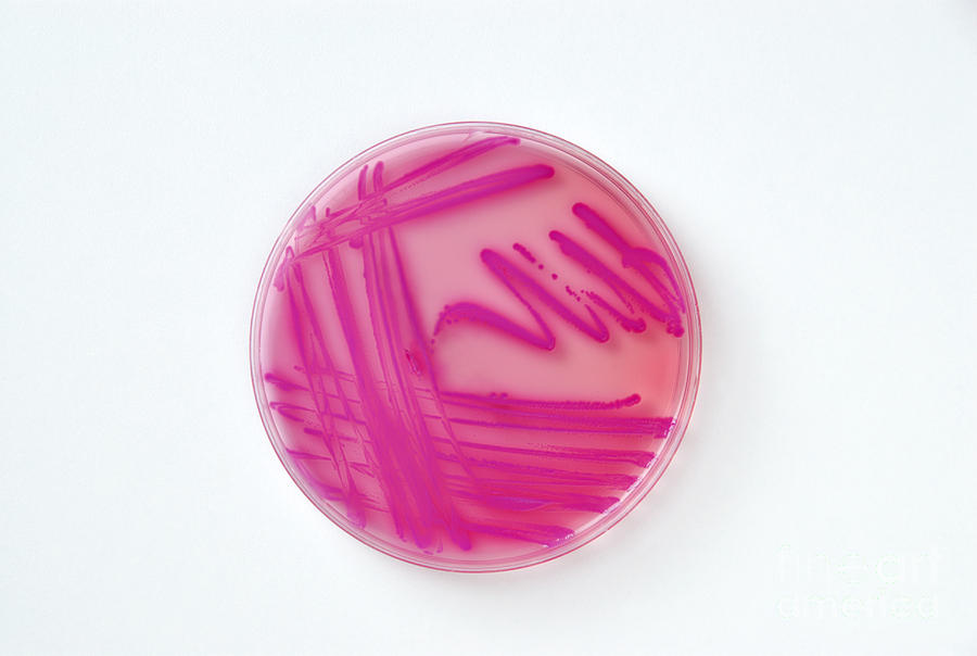 Petri Dish Of Acinetobacter Baumannii Photograph by George Mattei