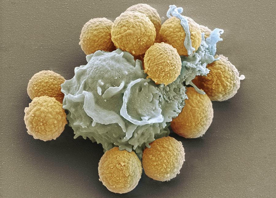 Aspergillus Fumigatus Photograph - Phagocytosis Of Fungal Spores, Sem by Prof Matthias Gunzer