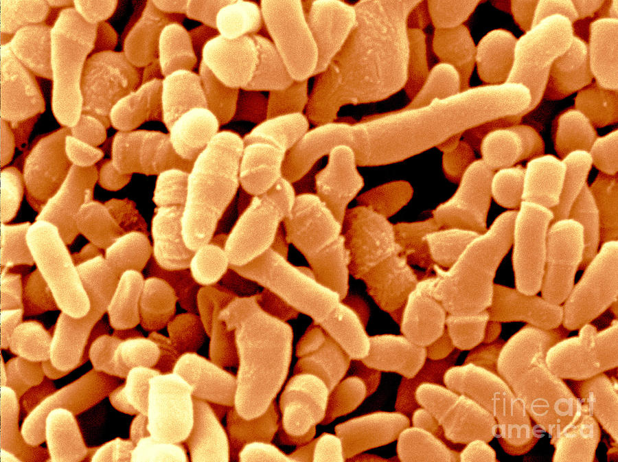 Propionibacterium Acnes Bacteria, Sem Photograph by Scimat