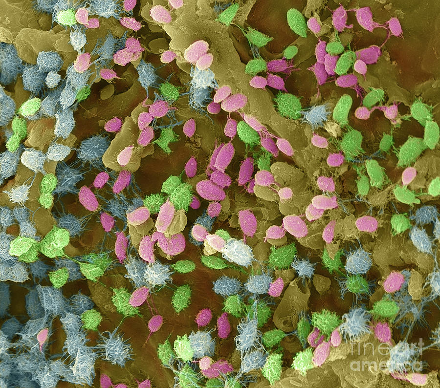 Protozoa on Cannabis Seed, SEM Photograph by Ted Kinsman