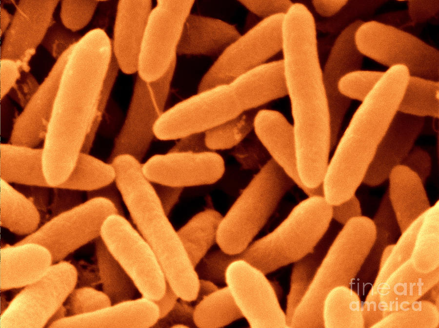 Pseudomonas Aeruginosa Photograph by Scimat