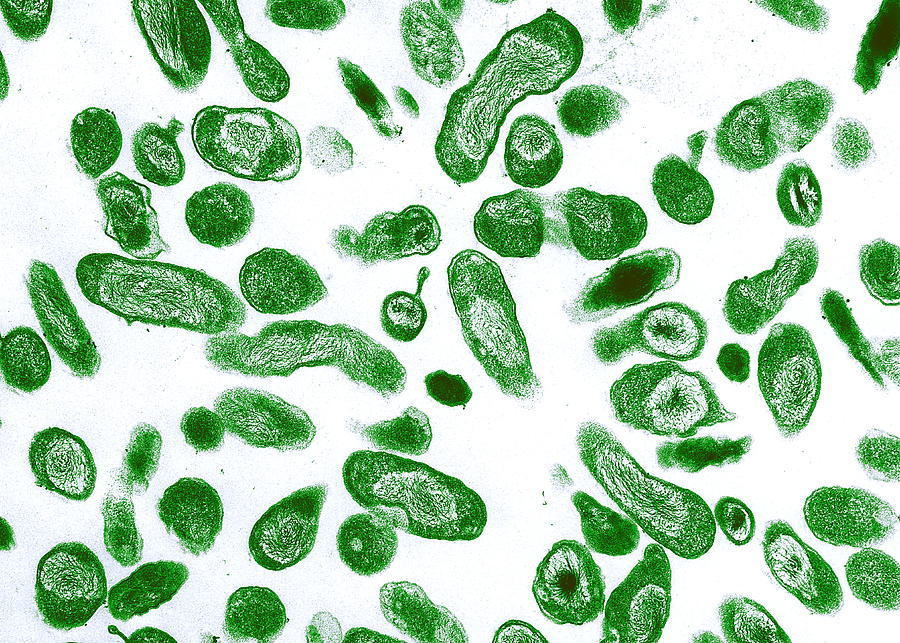 Bacteria Photograph - Q Fever Bacteria, Coxiella Burnetii, Tem by Niaidcdc