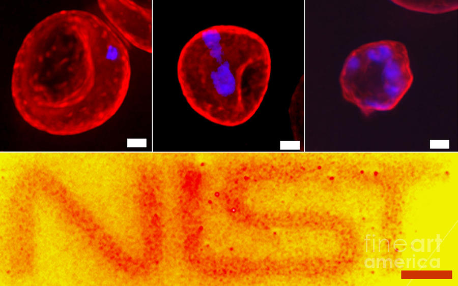 Quantum Dots, Malaria Progression, Sem Photograph by H. Kang/F. Tokumasu/NIAID/NIST