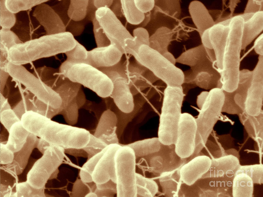 Salmonella Enteritidis Bacteria, Sem Photograph by Scimat