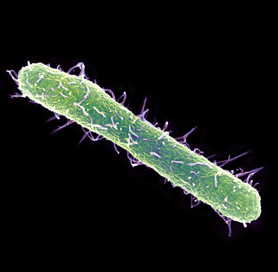 Serovar Typhimurium Photograph - Salmonella Typhimurium Bacterium, Sem by 