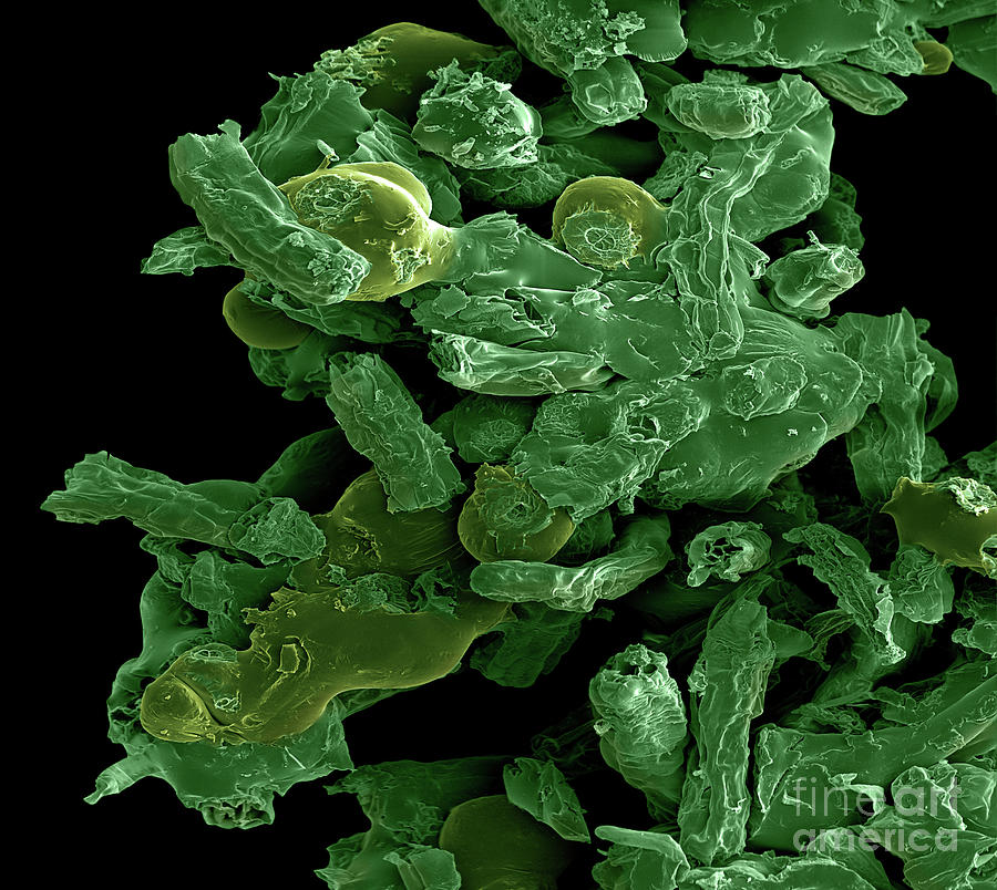 SEM Cannabis Trichomes in Hashish Photograph by Ted Kinsman
