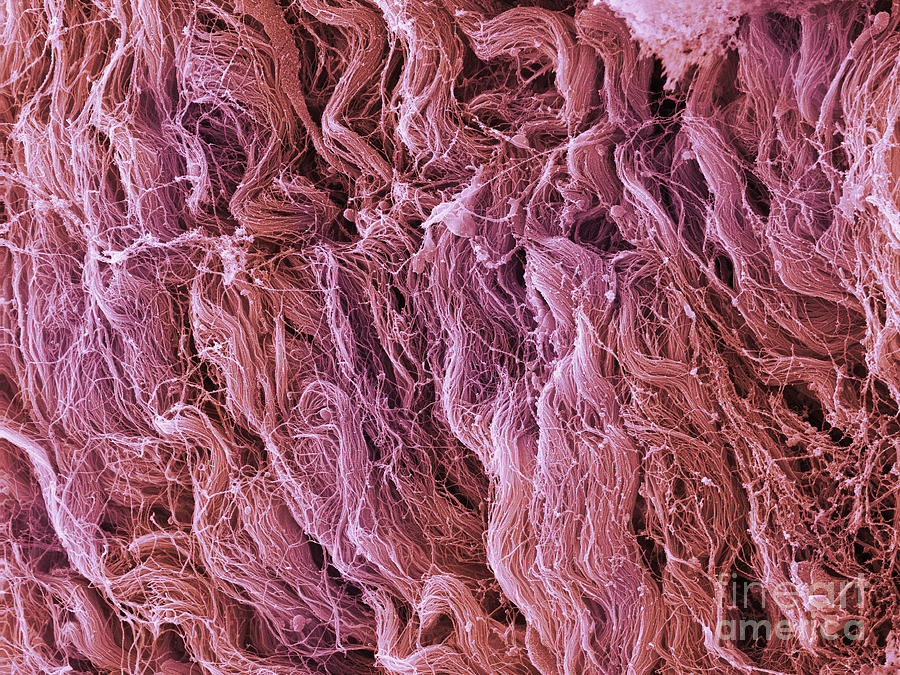 Sem Human Muscle Tissue Photograph by Ted Kinsman