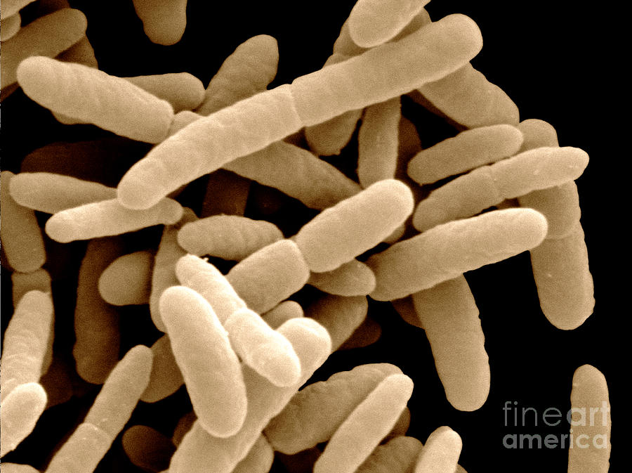 Sem Of E. Coli Bacteria Photograph by Scimat