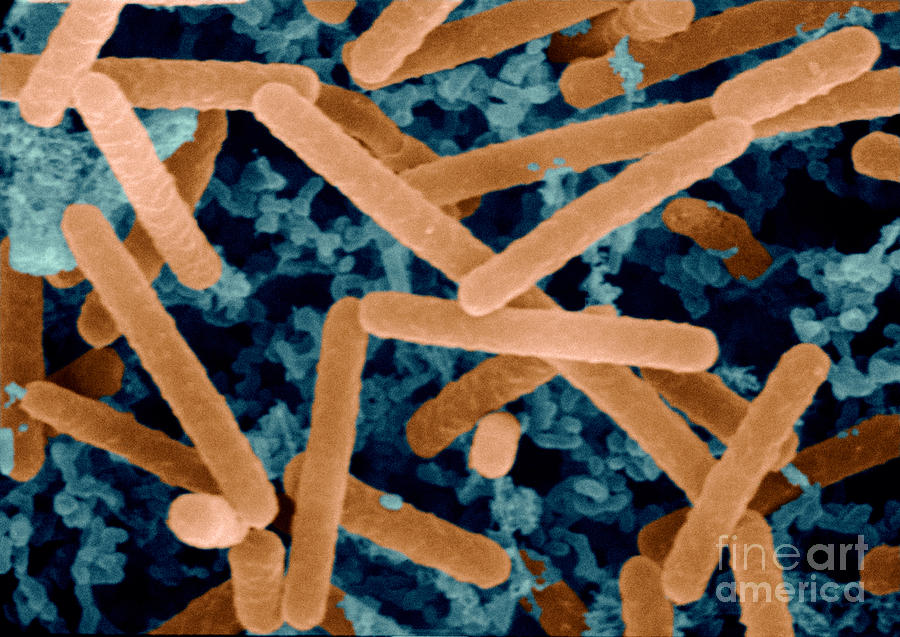 Sem Of Lactobacillus Acidophilus Photograph by Scimat