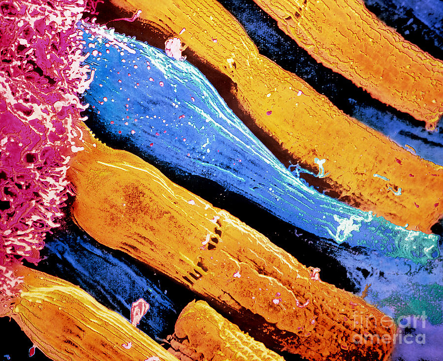 Sem Of Rod & Cone Cells In The Retina Photograph by Bill Longcore