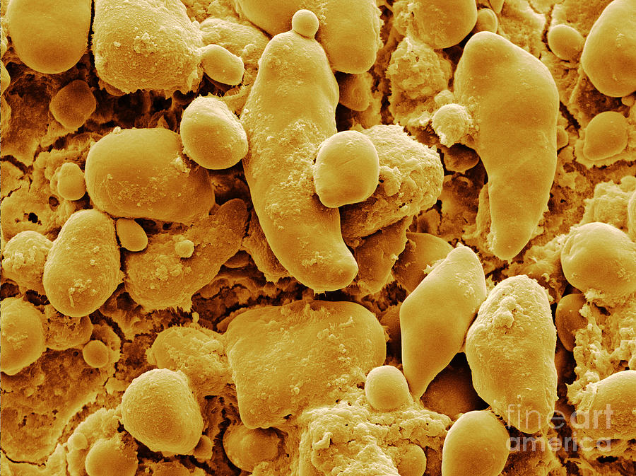 Sem Of Starch Granules Photograph by Scimat