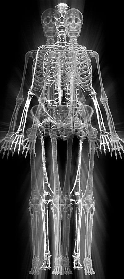 Skeleton Digital Art - Skeletons - X-Ray by Steve Ohlsen