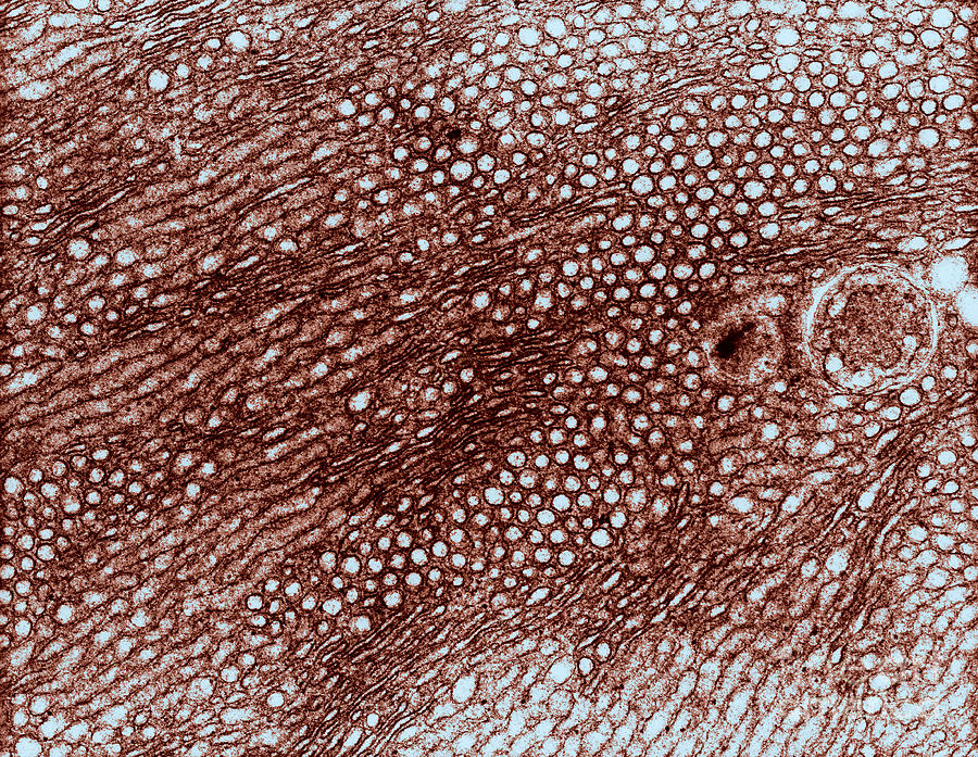 Histology Photograph - Smooth Endoplasmic Reticulum, Tem by David M. Phillips