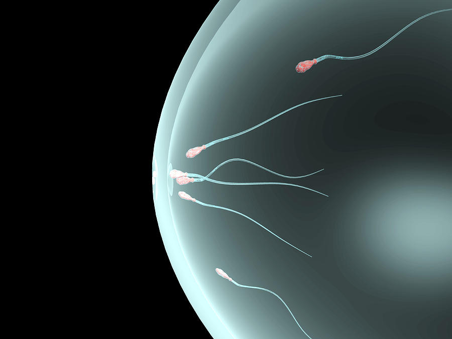 Device Photograph - Sperm Cells In A Condom by Christian Darkin
