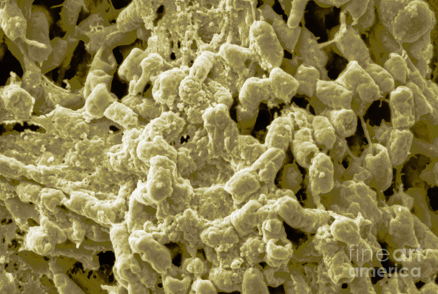 Spontaneous Bacterial Growth Photograph by Scimat