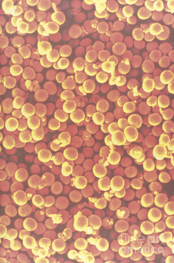 Staphylococcus Aureus Photograph by Scimat