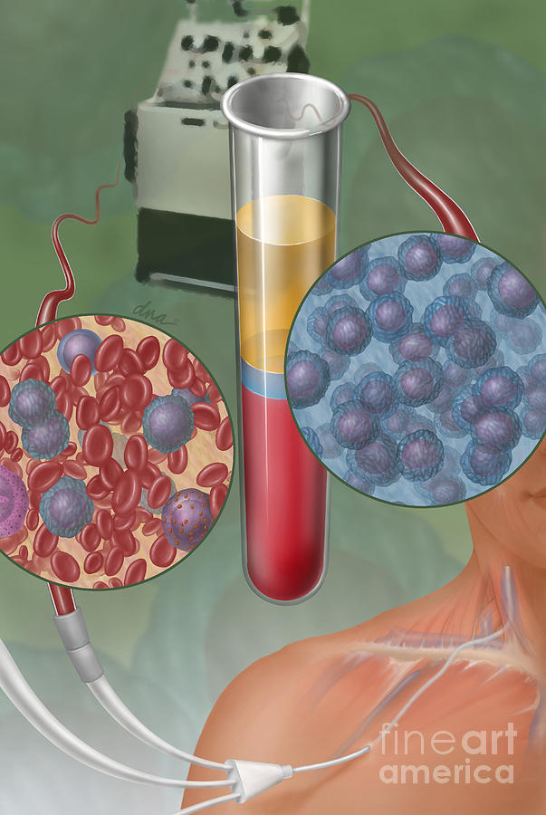 Stem Cell Transplantation, Illustration Photograph by DNA Illustrations