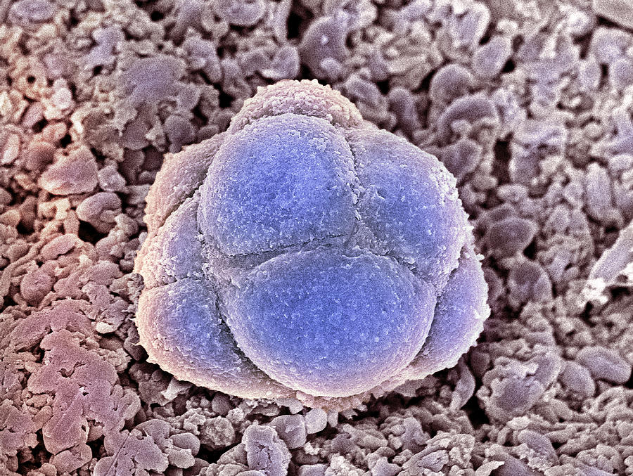 Stem Cells, Sem Photograph by Steve Gschmeissner